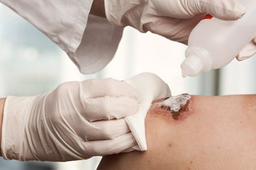 Enhancing Wound Healing with the Power of Debridement Brushes